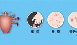揭秘小阴虫：生活习性与防治方法，保障家园健康