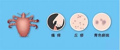 揭秘小阴虫：生活习性与防治方法，保障家园健康